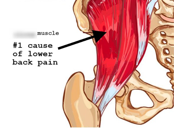 Lower back pain